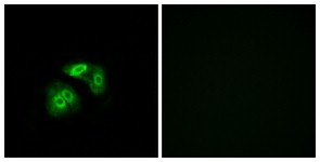 Immunocytochemistry/Immunofluorescence: VN1R5 Antibody [NBP1-71320] - Analysis of A549 cells, using VN1R5 Antibody. The picture on the right is treated with the synthesized peptide.