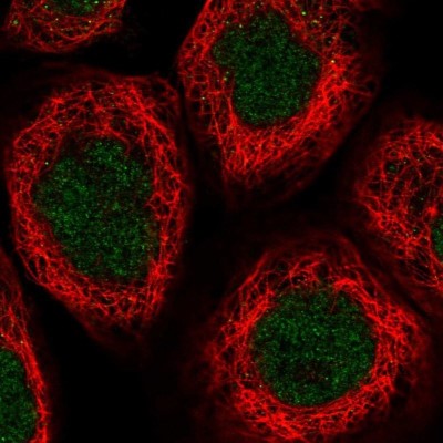 Immunocytochemistry/Immunofluorescence: Mic1 Antibody [NBP2-14389] - Staining of human cell line A-431 shows positivity in nucleus.