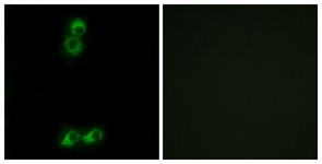 Immunocytochemistry/Immunofluorescence: OR10J5 Antibody [NBP1-71348] - Analysis of MCF7 cells, using OR10J5 Antibody. The picture on the right is treated with the synthesized peptide.