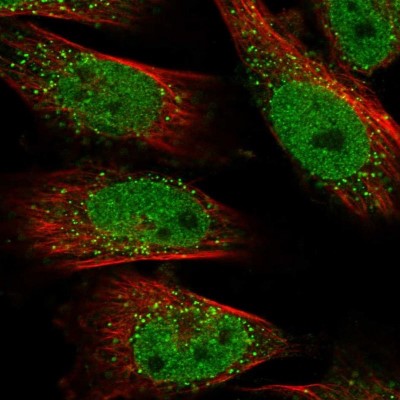 Immunocytochemistry/Immunofluorescence: LZTR2 Antibody [NBP1-92093] - Staining of human cell line U-251MG shows positivity in nucleus but not nucleoli & vesicles.