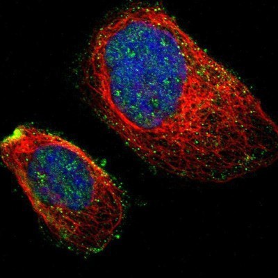 Immunocytochemistry/Immunofluorescence: ZNF22 Antibody [NBP1-81739] - Staining of human cell line A-431 shows positivity in nucleoli, nucleus but not nucleoli & plasma membrane.