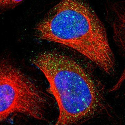 Immunocytochemistry/Immunofluorescence: LHPP Antibody [NBP1-83273] - Staining of human cell line U-2 OS shows positivity in nucleus & cytoplasm.
