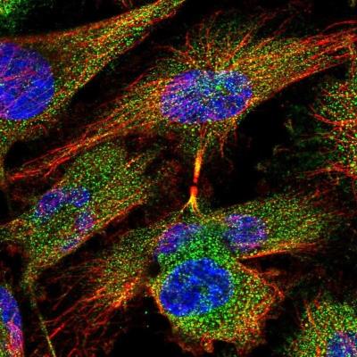 Immunocytochemistry/ Immunofluorescence: PLAC1L Antibody [NBP1-83488] -  Staining of human cell line U-251 MG shows positivity in cytoplasm.