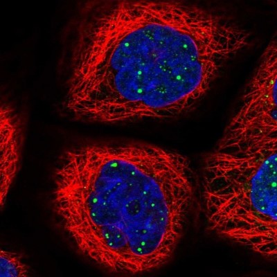 Immunocytochemistry/Immunofluorescence: WDR76 Antibody [NBP1-82273] - Immunofluorescent staining of human cell line A-431 shows positivity in nucleus.