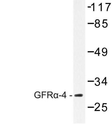 Western Blot: GFR alpha-4/GDNF R alpha-4/Persephin receptor Antibody [NBP1-00848] - Extracts from HeLa cells.