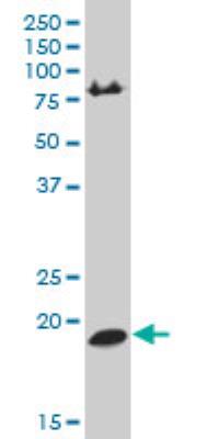 Western Blot: HRAS like suppressor Antibody [H00057110-A01] - ASLS polyclonal antibody (A01), Lot # 060623JCS1 Western Blot analysis of HRASLS expression in HepG2 ( Cat # L019V1 ).