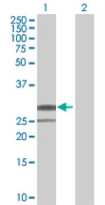 Western Blot: Protease Inhibitor 15 Antibody [H00051050-B01] - analysis of PI15 expression in transfected 293T cell line by PI15 MaxPab polyclonal antibody (B01). Lane 1: PI15 transfected lysate (29.10 KDa). Lane 2: Non-transfected lysate.