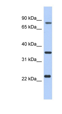 Western Blot: C17orf82 Antibody [NBP1-56810] - LN18 cell lysate, concentration 0.2-1 ug/ml.