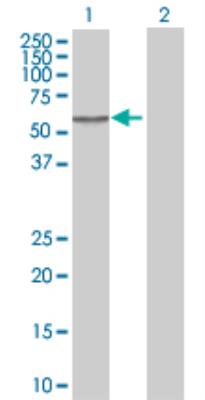 Western Blot: Chordin-like 1/CHRDL1 Antibody [H00091851-B01] - analysis of CHRDL1 expression in transfected 293T cell line by CHRDL1 MaxPab polyclonal antibody (B01). Lane 1: CHRDL1 transfected lysate (51.20 KDa). Lane 2: Non-transfected lysate.