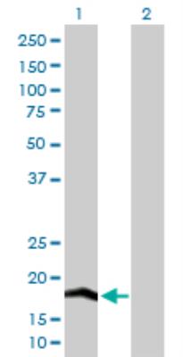 Western Blot: COX IV Isoform 2 Antibody [H00084701-D01P] - analysis of COX4I2 expression in transfected 293T cell line by COX4I2 MaxPab rabbit polyclonal antibody. Lane 1: COX4I2 transfected lysate (20.00 KDa). Lane 2: Non-transfected lysate.