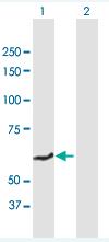 Western Blot: Ferroportin 1 Antibody [H00030061-B01] - Expression in transfected 293T cell line. Lane 1: SLC40A1 transfected lysate(62.81 KDa). Lane 2: Non-transfected lysate.