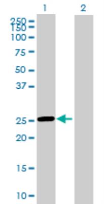 Western Blot: Ropporin 1-like Antibody [H00083853-B01] - analysis of ROPN1L expression in transfected 293T cell line by ROPN1L MaxPab polyclonal antibody. Lane 1: ROPN1L transfected lysate (25.3 KDa). Lane 2: Non-transfected lysate.