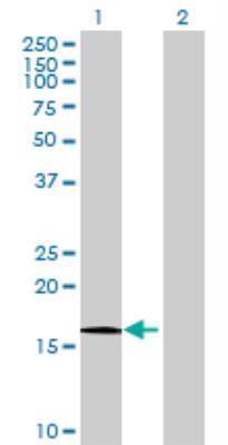 Western Blot: HRAS like suppressor Antibody [H00057110-B01] - analysis of HRASLS expression in transfected 293T cell line by HRASLS MaxPab polyclonal antibody (B01). Lane 1: HRASLS transfected lysate (18.80 KDa). Lane 2: Non-transfected lysate.