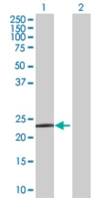 Western Blot: Hematopoietic Prostaglandin D Synthase/HPGDS Antibody [H00027306-B01] - analysis of PGDS expression in transfected 293T cell line by PGDS MaxPab polyclonal antibody (B01). Lane 1: PGDS transfected lysate (23.30 KDa). Lane 2: Non-transfected lysate.