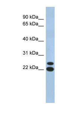 Western Blot: C19orf54 Antibody [NBP1-91469] - Human Muscle lysate, concentration 0.2-1 ug/ml.