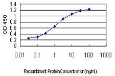 ELISA: RB associated KRAB repressor Antibody (6F9) [H00057786-M01] - Detection limit for recombinant GST tagged RBAK is approximately 0.03ng/ml as a capture antibody.