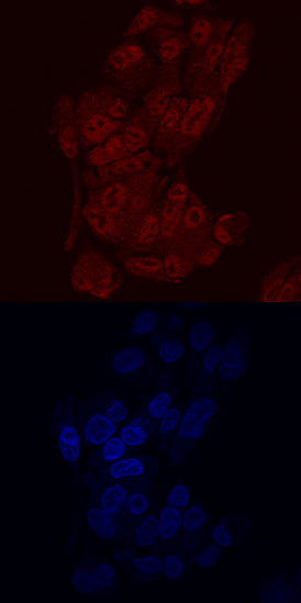 Immunocytochemistry ONECUT2/OC-2 Antibody