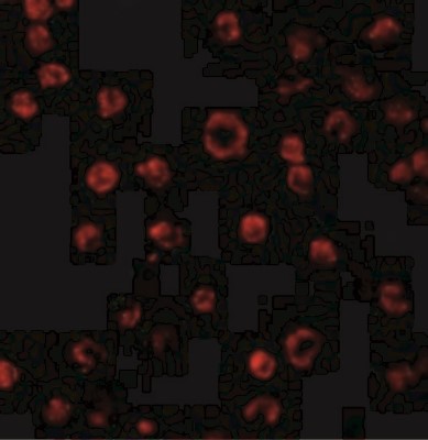 Immunocytochemistry/Immunofluorescence: TLR3 Antibody [NBP1-76660] - Immunofluorescence of TLR3 in K562 cells with TLR3 antibody at 2 ug/mL.