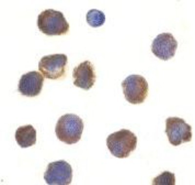 Immunocytochemistry/Immunofluorescence: TLR3 Antibody [NBP1-76660] - K562 cells with TLR3 antibody at 10 ug/ml.