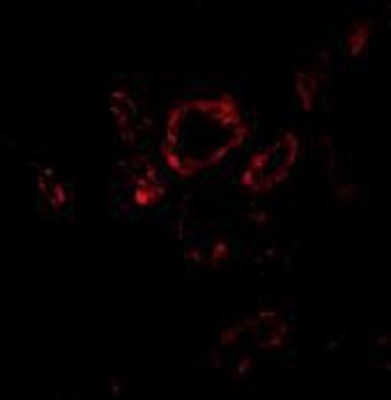 Immunocytochemistry/Immunofluorescence: Slug Antibody [NBP1-76733] - Immunofluorescence of Slug in human kidney tissue with Slug antibody at 20 ug/ml.