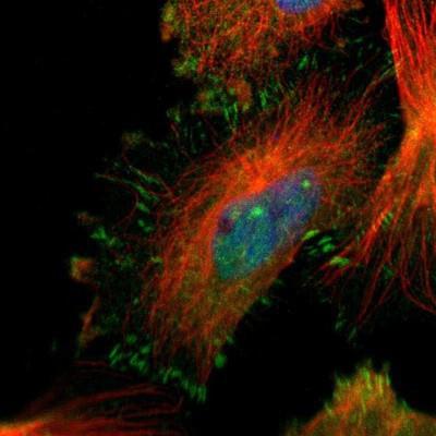 Immunocytochemistry/Immunofluorescence: Myosin Heavy Chain Antibody [NBP1-85542] - Staining of human cell line U-251MG shows positivity in nucleus but not nucleoli, cytoplasm & focal adhesions.