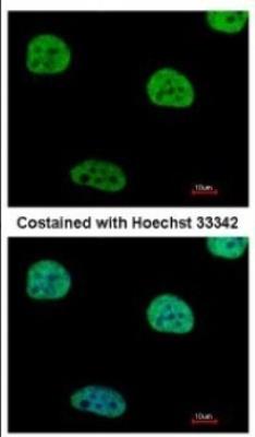 Immunocytochemistry/Immunofluorescence: HIV-1 Rev binding protein (HRB) Antibody [NBP2-16849] - Analysis of paraformaldehyde-fixed HeLa, using antibody at 1:500 dilution.
