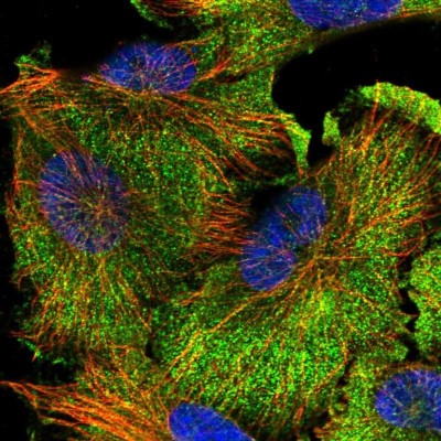 Immunocytochemistry/Immunofluorescence: LRRC25 Antibody [NBP1-83476] - Staining of human cell line U-251MG shows positivity in cytoplasm.