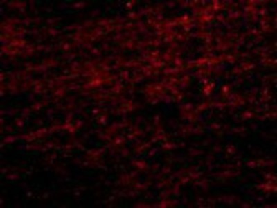 Immunocytochemistry/Immunofluorescence: CLIP170 Antibody [NBP1-76921] - Immunofuorescence of CLIP170 in human brain tissue with CLIP170 antibody at 20 ug/ml.