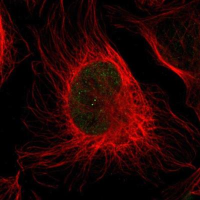 Immunocytochemistry/Immunofluorescence: Myosin Heavy Chain Antibody [NBP1-87025] - Immunofluorescent staining of human cell line U-2 OS shows positivity in nuclei.