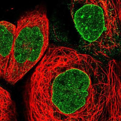 Immunofluorescence: SLC39A10 Antibody [NBP1-85080] - Staining of human cell line A-431 shows positivity in nucleus but not nucleoli & nuclear membrane.