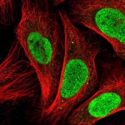 Immunocytochemistry/Immunofluorescence: BARD1 Antibody [NBP2-47543] - Analysis of human cell line U-2 OS shows positivity in nucleoli, vesicles & nucleus but excluded from the nucleoli.