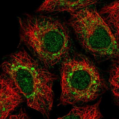 Immunocytochemistry/Immunofluorescence: METT5D1 Antibody [NBP2-47378] - Analysis of human cell line A549 shows positivity in mitochondria & nucleus but excluded from the nucleoli.