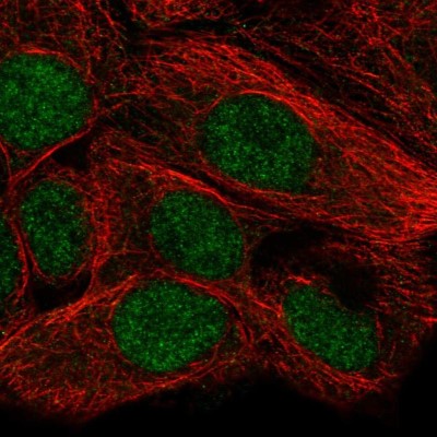 Immunocytochemistry/Immunofluorescence: FAM50B Antibody [NBP2-49529] - Analysis of human cell line MCF7 shows positivity in nucleus.