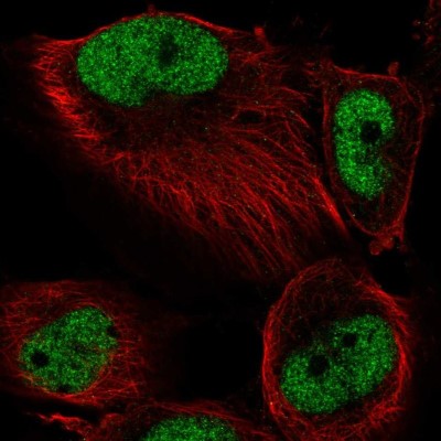 Immunocytochemistry/Immunofluorescence: SETD1A Antibody [NBP2-49281] - Analysis of human cell line U-251 MG shows positivity in nucleus but excluded from the nucleoli.
