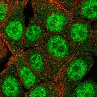 Immunocytochemistry/Immunofluorescence: CHMP4A Antibody [NBP2-49557] - Analysis of human cell line MCF7 shows positivity in cytoplasm & nucleus but excluded from the nucleoli.