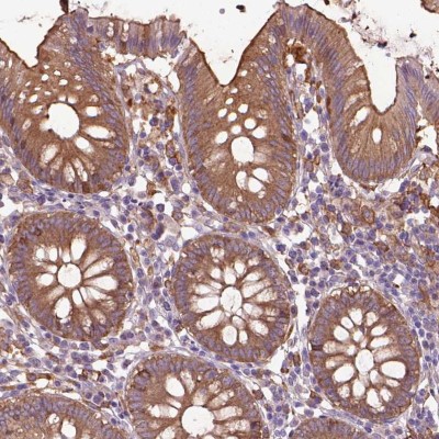 Immunohistochemistry: CORO1B Antibody [NBP2-49634] - Staining of human colon shows moderate cytoplasmic and membranous positivity in glandular cells.