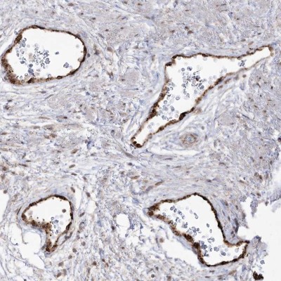 Immunohistochemistry: C4orf21/prematurely terminated mRNA decay factor-like Antibody [NBP2-48596] - Staining of human prostate shows strong cytoplasmic positivity in endothelial cells.