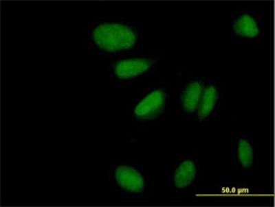 Immunocytochemistry/Immunofluorescence: ZNF133 Antibody [H00007692-B02] - Immunofluorescence of purified MaxPab antibody to ZNF133 on HeLa cell. [antibody concentration 10 ug/ml]