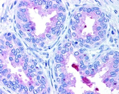 Immunocytochemistry/Immunofluorescence: ABCA1 Antibody [NB400-105] - Detection of ABCA1 in prostate epithelium showing luminal and membrane staining.