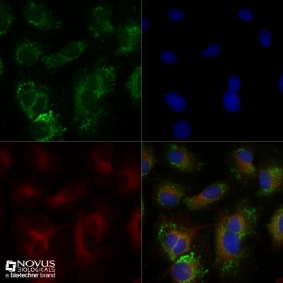 Immunocytochemistry/Immunofluorescence: ABCA1 Antibody [NB400-105] - Untreated HepG2 cells were grown to 60% confluency, and serum starved for 24 hours prior to being fixed for 10 minutes using 10% formalin and then permeabilized for 5 minutes using 1X TBS + 0.5% Triton-X100. The cells were incubated with anti-ABCA1 at 5.0ug/ml overnight at 4C and detected with an anti-rabbit Dylight 488 (Green) at a 1:500 dilution. Alpha tubulin (DM1A) NB100-690 was used as a co-stain at a 1:1000 dilution and detected with an anti-mouse Dylight 550 (Red) at a 1:500 dilution. Nuclei were counterstained with DAPI (Blue). Cells were imaged using a 40X objective. 