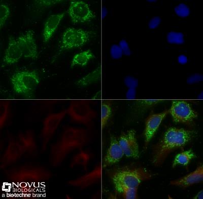 Immunocytochemistry/Immunofluorescence: ABCA1 Antibody [NB400-105] - HepG2 cells were grown to 60% confluency, serum starved for 24 hours, and then treated with 1uM TO9 for 24 hours prior to being fixed for 10 minutes using 10% formalin and then permeabilized for 5 minutes using 1X TBS + 0.5% Triton-X100. The cells were incubated with anti-ABCA1 at 5.0ug/ml overnight at 4C and detected with an anti-rabbit Dylight 488 (Green) at a 1:500 dilution. Alpha tubulin (DM1A) NB100-690 was used as a co-stain at a 1:1000 dilution and detected with an anti-mouse Dylight 550 (Red) at a 1:500 dilution. Nuclei were counterstained with DAPI (Blue). Cells were imaged using a 40X objective. 