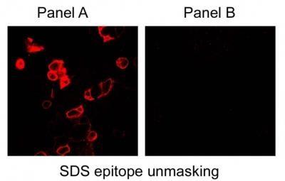 Immunocytochemistry/Immunofluorescence: Carbonic Anhydrase IX/CA9 Antibody [NB100-417] - Analysis of HRP conjugate of NB100-417. HEK 293 cells using NB100-417. Panel A shows CAIX-transfected cells (epitope-unmasked with SDS) and panel B shows mock transfected cells.