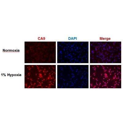 Immunocytochemistry/Immunofluorescence: Carbonic Anhydrase IX/CA9 Antibody [NB100-417] - Analysis using the DyLight 488 conjugate of NB100-417. Staining of Carbonic Anhydrase IX (red) in human glioma U87 cells. DAPI counterstains nuclei (blue). Image provided via product review by verified customer.