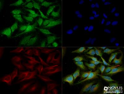 Immunocytochemistry/Immunofluorescence: ATG5 Antibody [NB110-53818] - HeLa cells were fixed for 10 minutes using 10% formalin and then permeabilized for 5 minutes using 1X TBS + 0.5% Triton-X100. The cells were incubated with anti-ATG5 [NB110-53818] at a 1:200 dilution overnight at 4C and detected with an anti-rabbit Dylight 488 (Green) at a 1:500 dilution. Alpha tubulin (DM1A) NB100-690 was used as a co-stain at a 1:1000 dilution and detected with an anti-mouse Dylight 550 (Red) at a 1:500 dilution. Nuclei were counterstained with DAPI (Blue). Cells were imaged using a 40X objective.