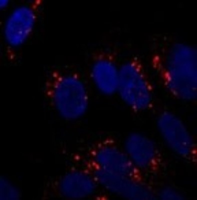 Immunocytochemistry/Immunofluorescence: ATG5 Antibody [NB110-53818] - Staining of SY5Y cells at 1:250. Incubated overnight at 4 degrees. Photo courtesy of an anonymous collaborator.