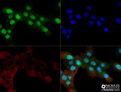 Immunocytochemistry/Immunofluorescence: OGG1 Antibody [NB100-106] - A431 cells were fixed for 10 minutes using 10% formalin and then permeabilized for 5 minutes using 1X TBS + 0.5% Triton-X100.  The cells were incubated with anti-hOgg1 [NB100-106] at a 1:200 dilution overnight at 4C and detected with an anti-rabbit Dylight 488 (Green) at a 1:500 dilution.  Alpha Tubulin (DM1A) [NB100-690] was used as a co-stain at a 1:1000 dilution and detected with an anti-mouse Dylight 550 (Red) at a 1:500 dilution.  Nuclei were counterstained with DAPI (Blue).  Cells were imaged using a 40X objective.