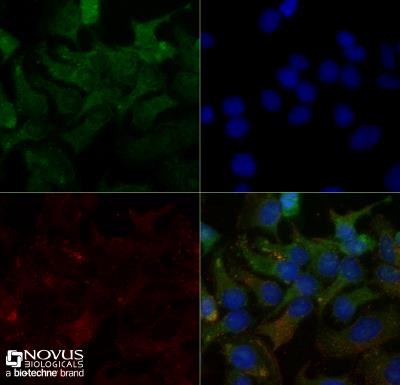 Immunocytochemistry/Immunofluorescence: SR-BI Antibody [NB400-101] - HeLa cells were fixed and permeabilized for 10 minutes using -20C MeOH. The cells were incubated with anti-SR-BI at 2 ug/ml overnight at 4C and detected with an anti-rabbit Dylight 488 (Green) at a 1:500 dilution. Alpha tubulin (DM1A) NB100-690 was used as a co-stain at a 1:1000 dilution and detected with an anti-mouse Dylight 550 (Red) at a 1:500 dilution. Nuclei were counterstained with DAPI (Blue). Cells were imaged using a 40X objective.