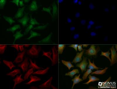 Immunocytochemistry/Immunofluorescence: CHREBP Antibody [NB400-135] - HeLa cells were fixed for 10 minutes using 10% formalin and then permeabilized for 5 minutes using 1X TBS + 0.5% Triton-X100. The cells were incubated with anti-ChREBP (NB400-135) at a 1:200 dilution overnight at 4C and detected with an anti-rabbit Dylight 488 (Green) at a 1:500 dilution. Alpha tubulin was used as a co-stain at a 1:1000 dilution and detected with an anti-mouse Dylight 550 (Red) at a 1:500 dilution. Nuclei were counterstained with DAPI (Blue). Cells were imaged using a 40X objective.