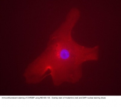 Immunocytochemistry/Immunofluorescence: CHREBP Antibody [NB400-135] - Immunofluorescent staining of a human hepatocyte using NB400-135. Overlay staining of ChREBP (rhodamine red) and DAPI nuclear staining (blue).