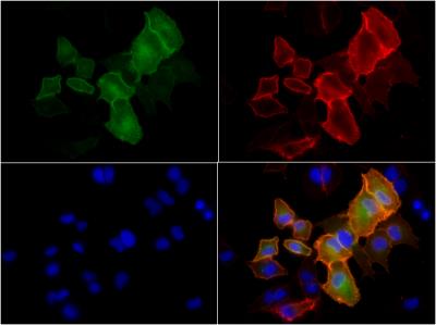 Immunocytochemistry/Immunofluorescence: B7-H1/PD-L1/CD274 Antibody [NBP1-76769] - ICC/IF analysis of PD-L1 protein in A549 cells which were stably transfected with human-PD-L1-GFP construct. PD-L1 antibody NBP1-76769 was used at 1:200 dilution which followed incubation of cells with Cy3-conjugated secondary antibody (see red colored surface staining of PDL1). Green color in the image represents GFP-PDL1 while nuclear bound DAPI is in blue color. This image was submitted by Anudari Letian from Weill Cornell Medical College (NY City, USA) via product review.